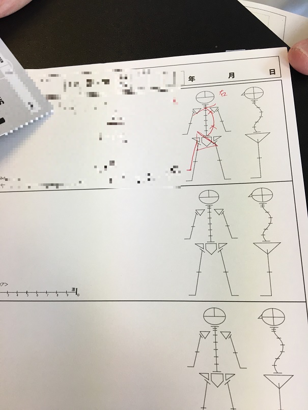 カラダファクトリーで調べてもらったカラダの歪みの図